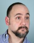 Before Hair Transplant&nbsp;Front